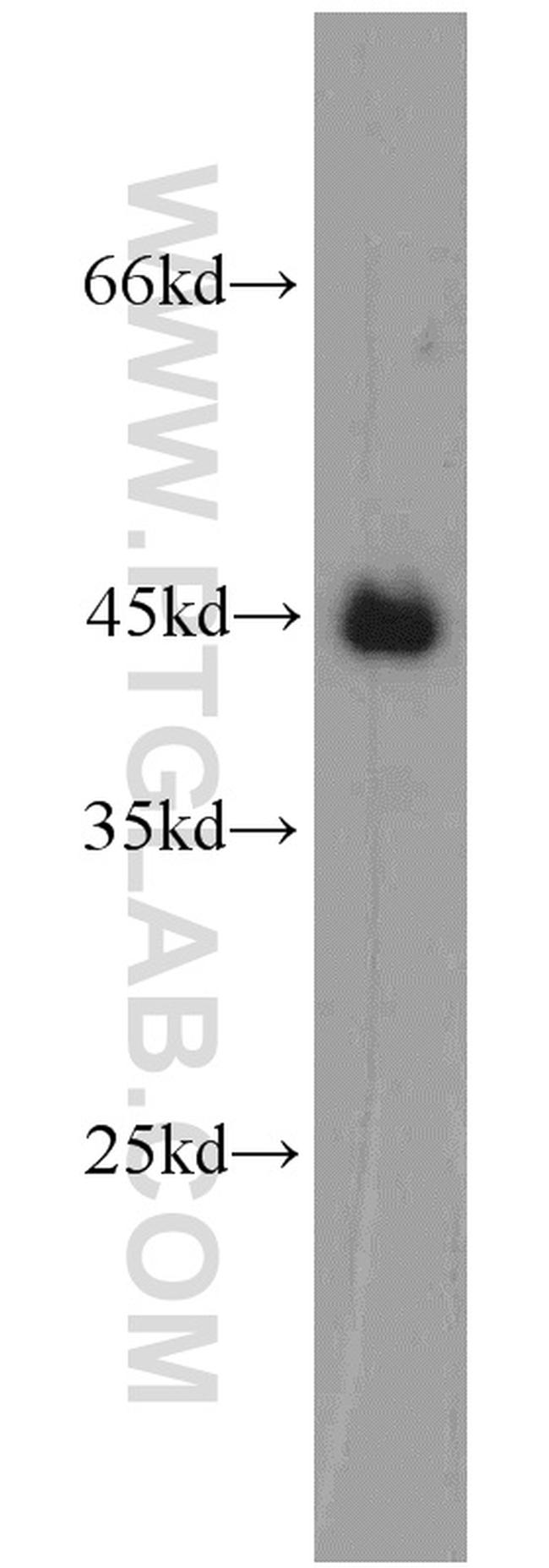 TDP-43 (C-terminal) Antibody in Western Blot (WB)