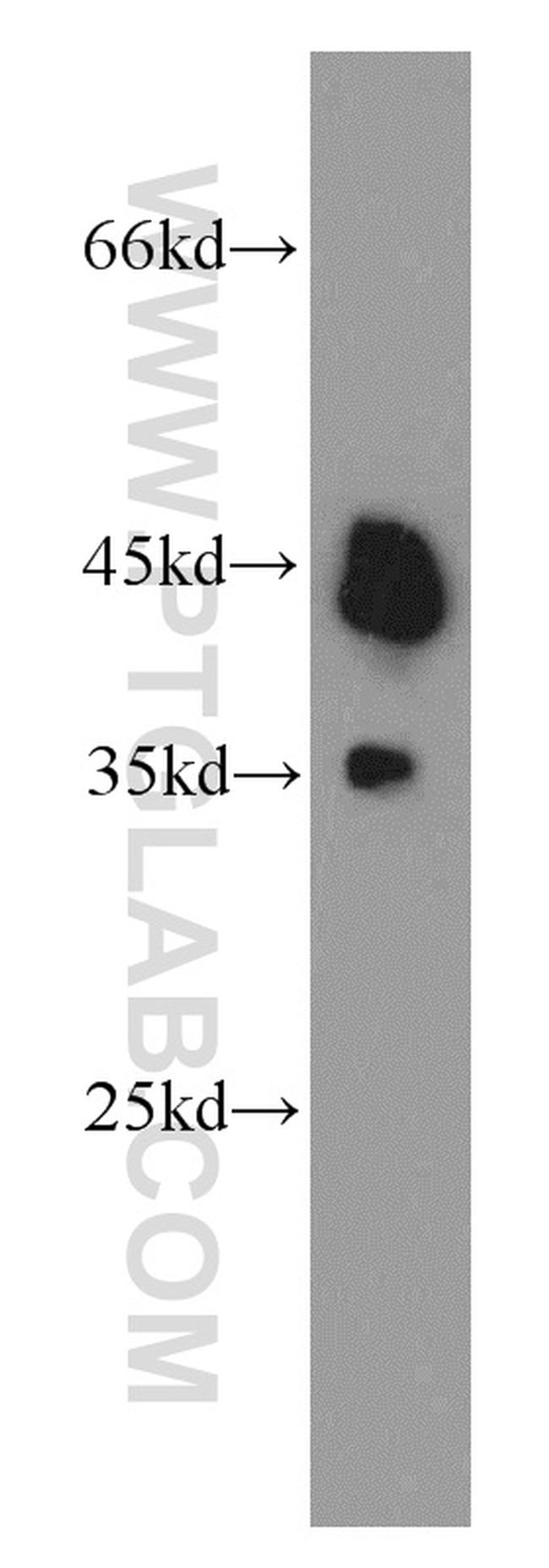 TDP-43 (C-terminal) Antibody in Western Blot (WB)