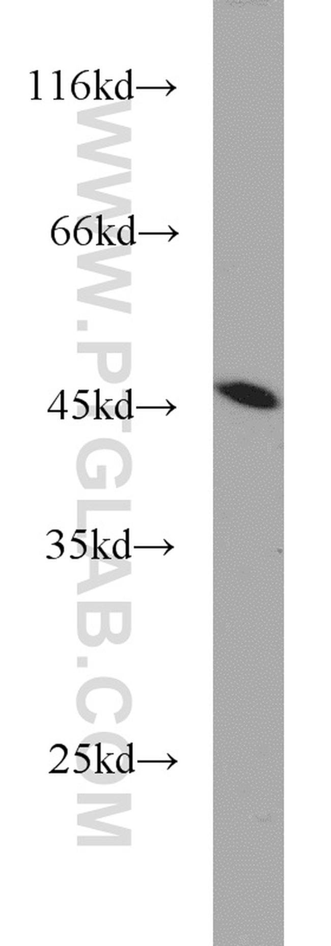 TDP-43 (C-terminal) Antibody in Western Blot (WB)