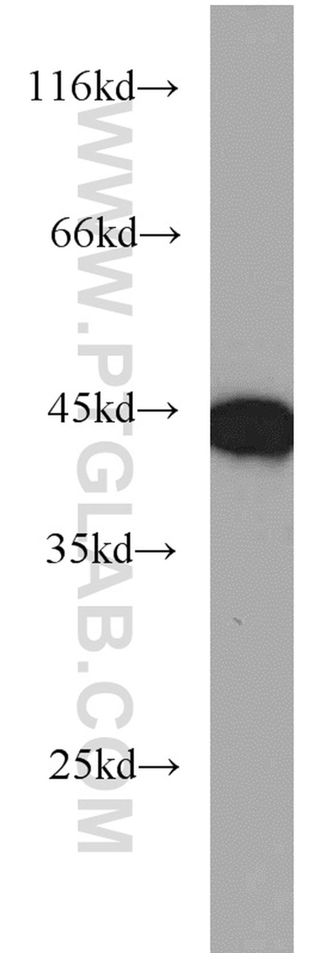 TDP-43 (C-terminal) Antibody in Western Blot (WB)