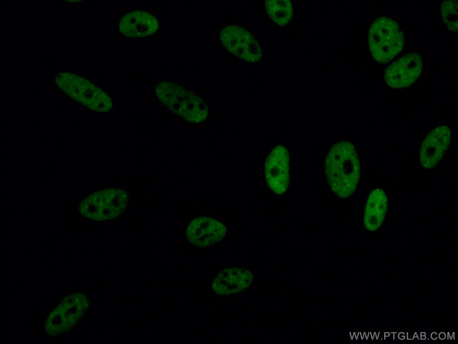 TDP-43 (C-terminal) Antibody in Immunocytochemistry (ICC/IF)