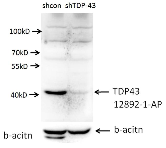 TDP-43 (C-terminal) Antibody in Western Blot (WB)