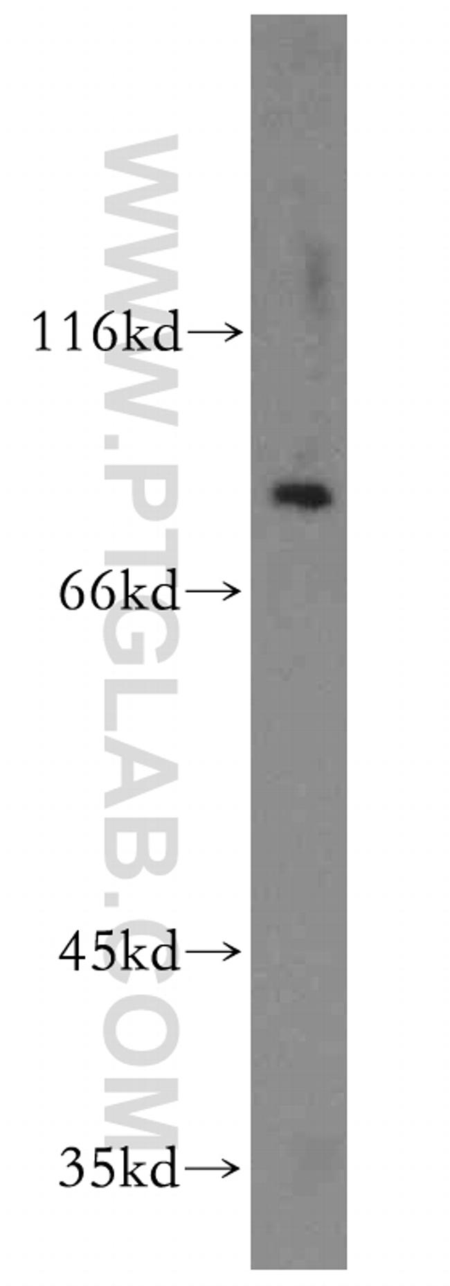 ST5 Antibody in Western Blot (WB)