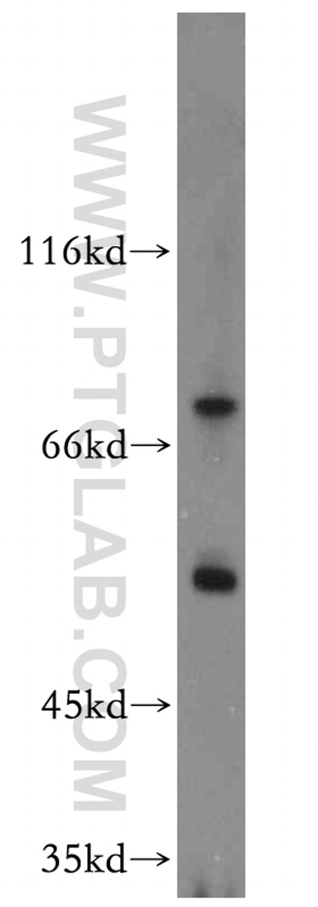 ST5 Antibody in Western Blot (WB)