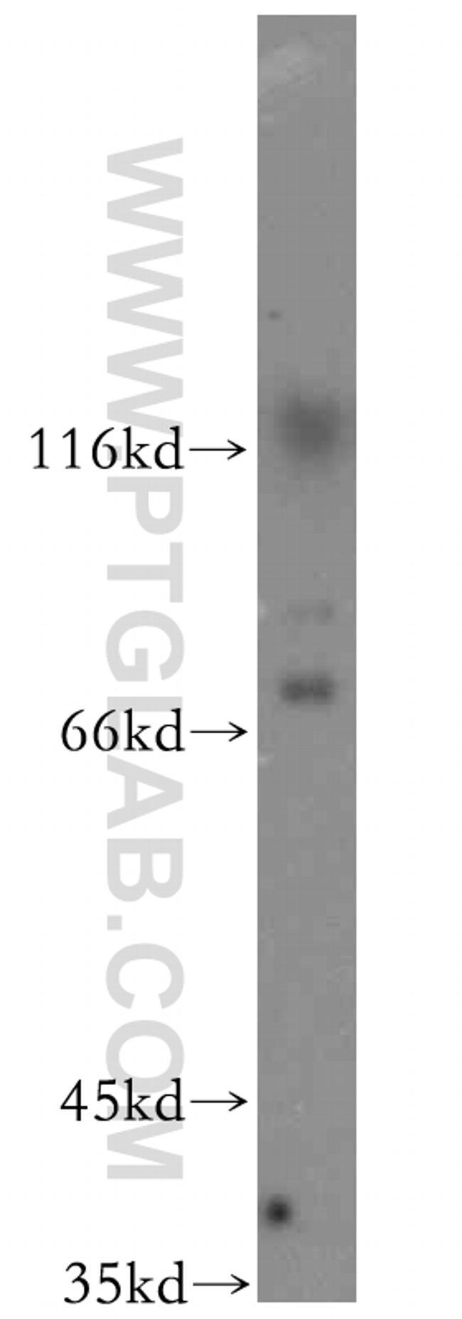 ST5 Antibody in Western Blot (WB)