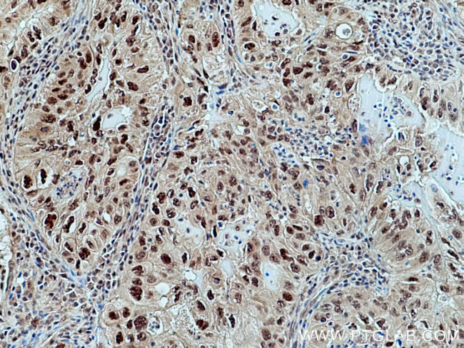 CUL1 Antibody in Immunohistochemistry (Paraffin) (IHC (P))