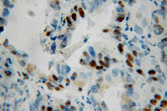 CUL1 Antibody in Immunohistochemistry (Paraffin) (IHC (P))