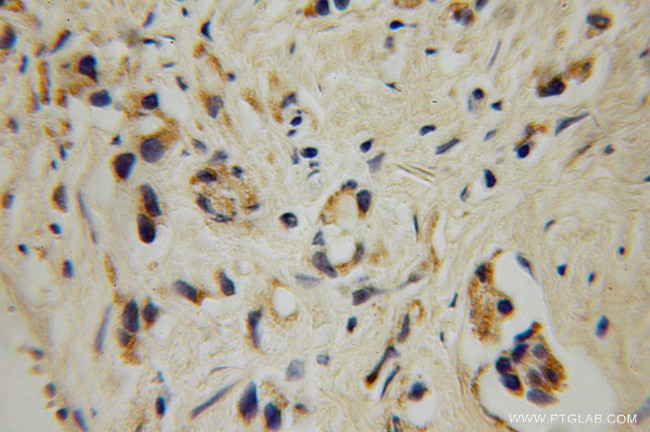 GALNT4 Antibody in Immunohistochemistry (Paraffin) (IHC (P))