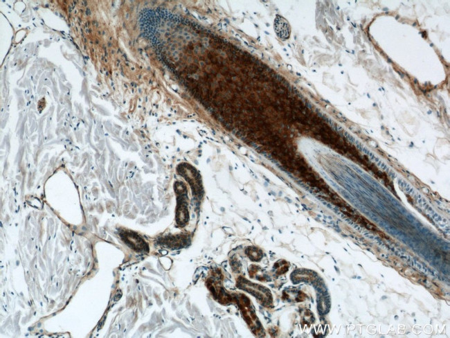 RCAN2 Antibody in Immunohistochemistry (Paraffin) (IHC (P))