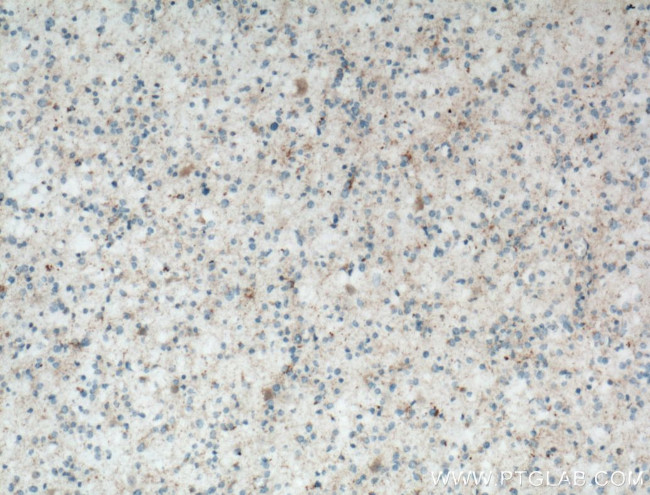 RCAN2 Antibody in Immunohistochemistry (Paraffin) (IHC (P))