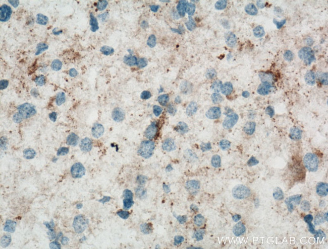 RCAN2 Antibody in Immunohistochemistry (Paraffin) (IHC (P))