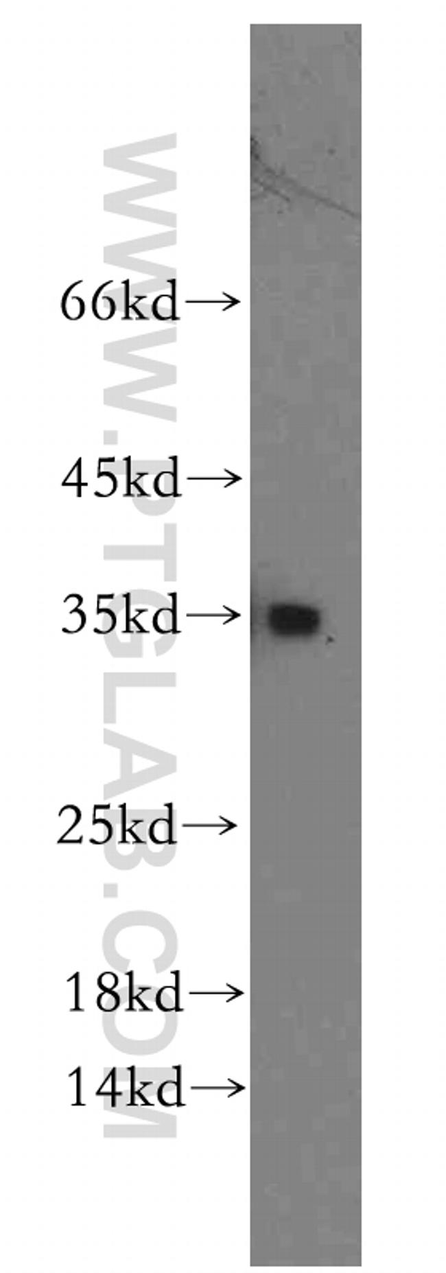 RCAN2 Antibody in Western Blot (WB)