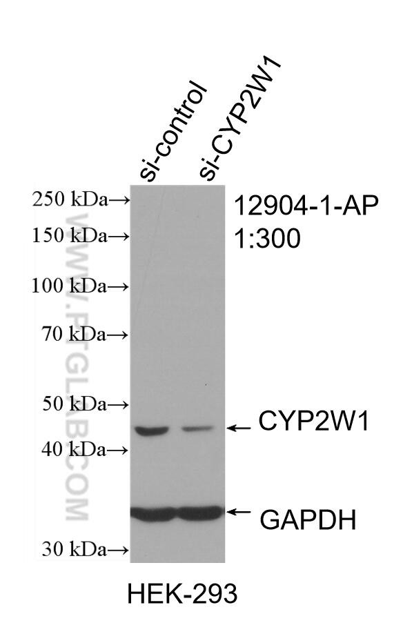 CYP2W1 Antibody in Western Blot (WB)