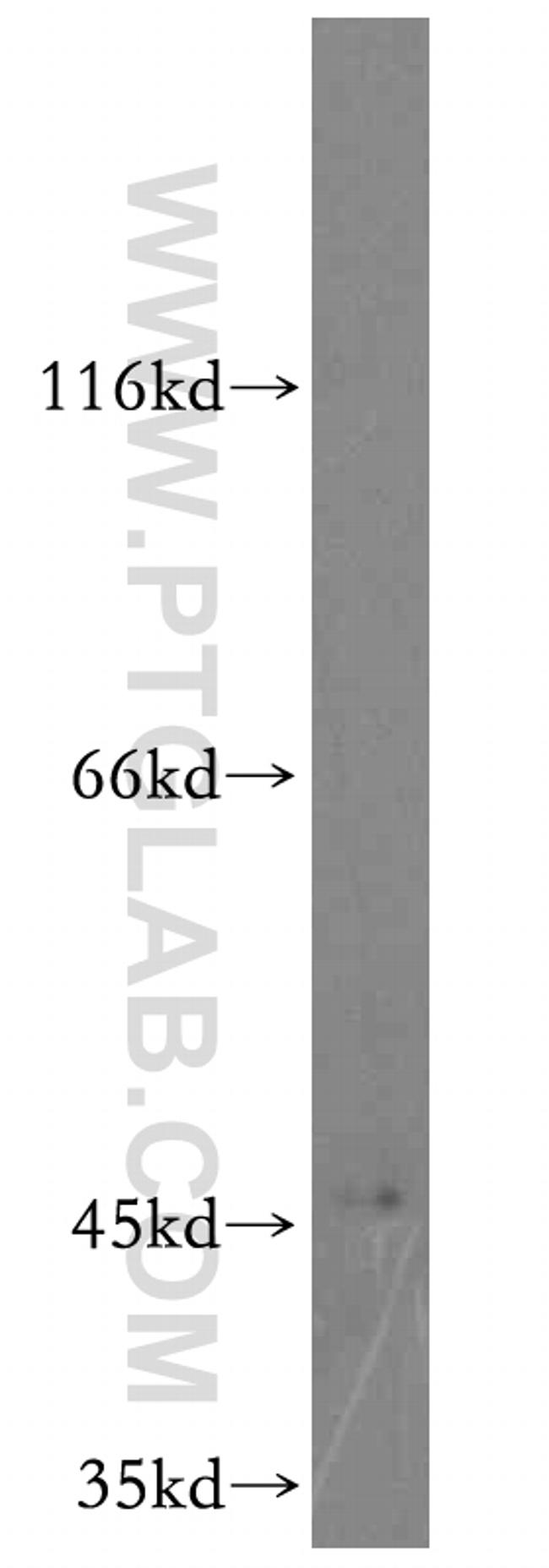 CYP2W1 Antibody in Western Blot (WB)