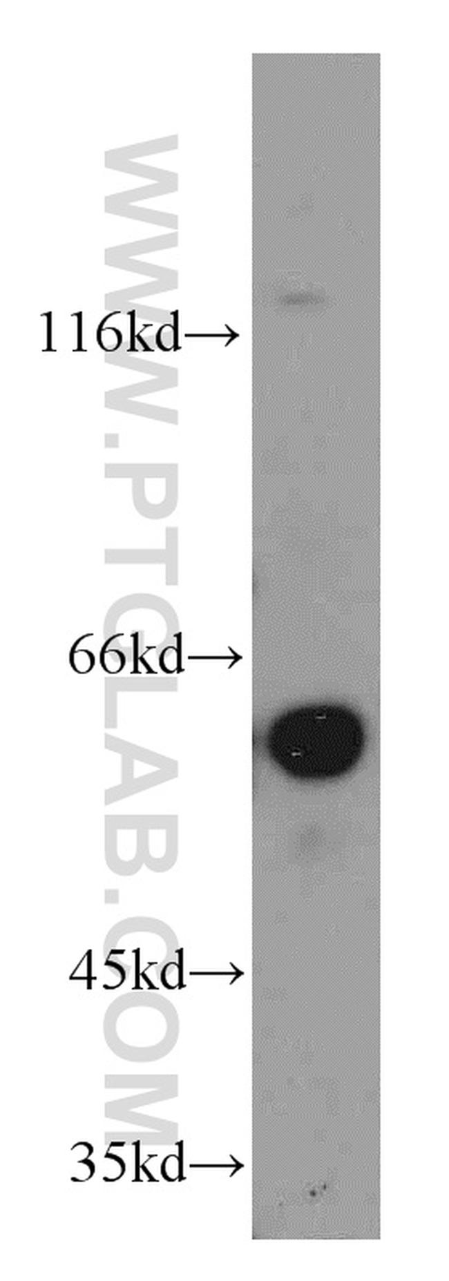 Netrin G1 Antibody in Western Blot (WB)