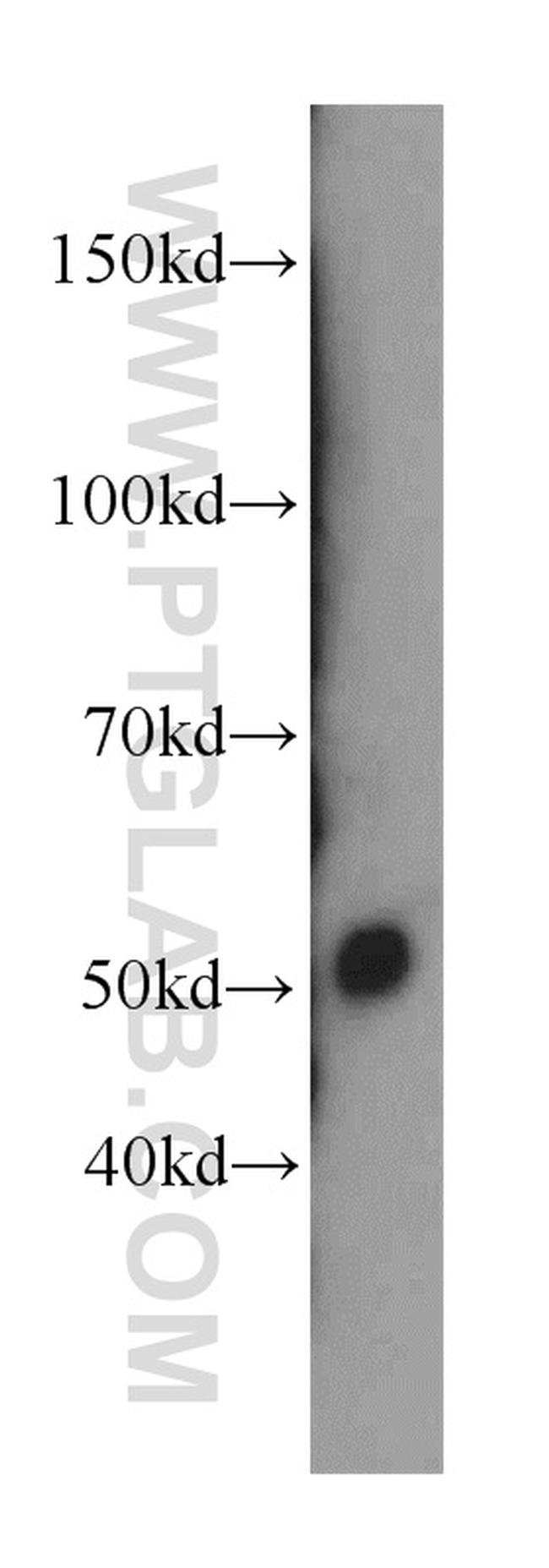 Netrin G1 Antibody in Western Blot (WB)