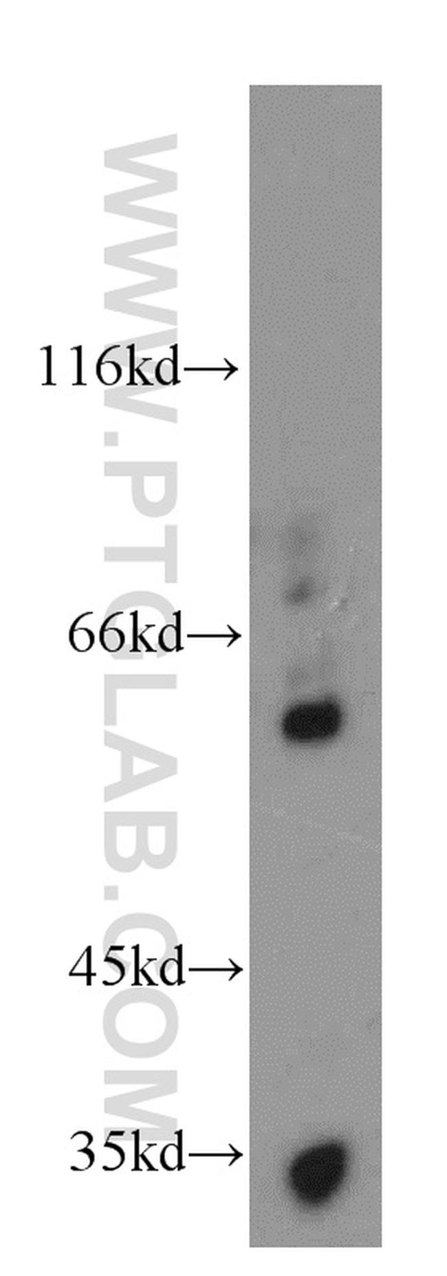 Netrin G1 Antibody in Western Blot (WB)