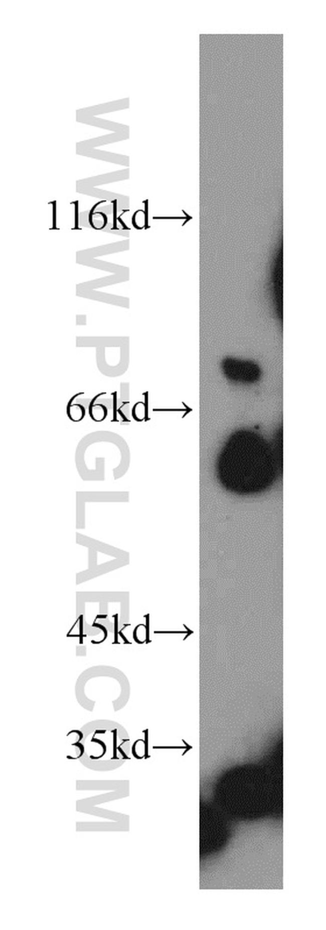 Netrin G1 Antibody in Western Blot (WB)