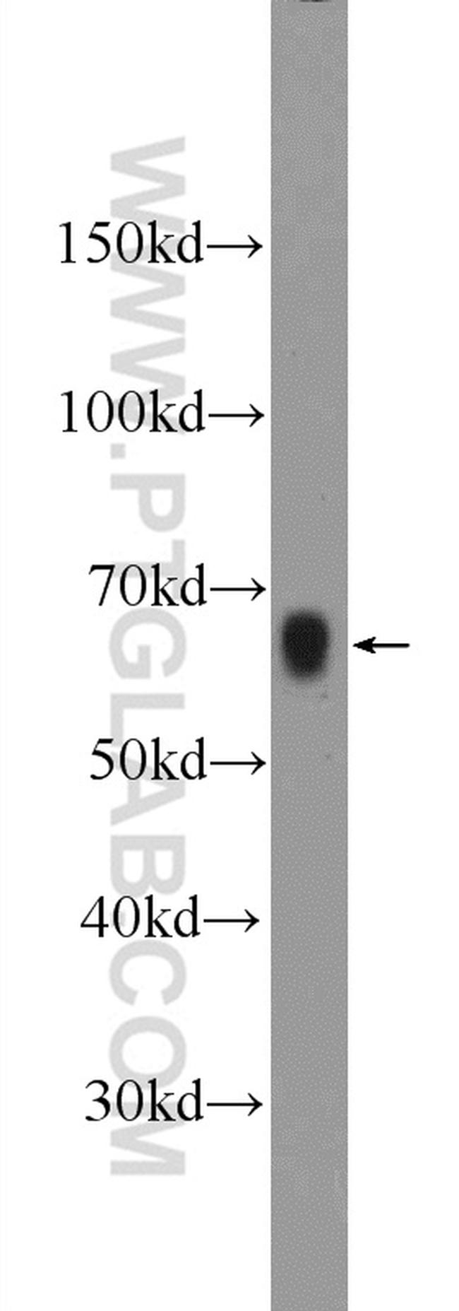 AOAH Antibody in Western Blot (WB)