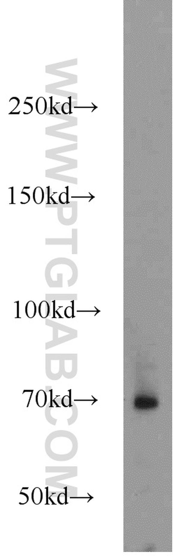 AOAH Antibody in Western Blot (WB)