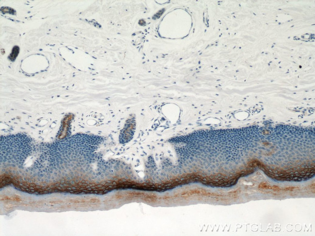 TGM1 Antibody in Immunohistochemistry (Paraffin) (IHC (P))