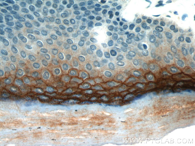 TGM1 Antibody in Immunohistochemistry (Paraffin) (IHC (P))