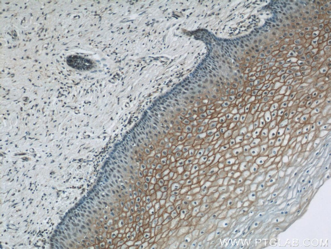 TGM1 Antibody in Immunohistochemistry (Paraffin) (IHC (P))