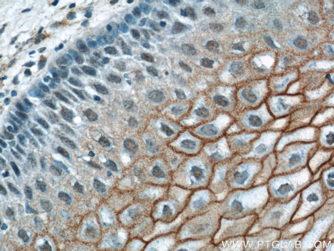 TGM1 Antibody in Immunohistochemistry (Paraffin) (IHC (P))