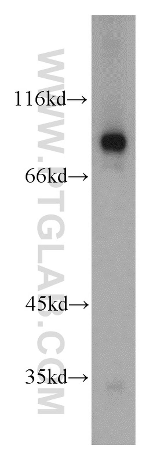 TGM1 Antibody in Western Blot (WB)