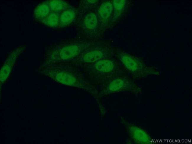 CUL4B Antibody in Immunocytochemistry (ICC/IF)