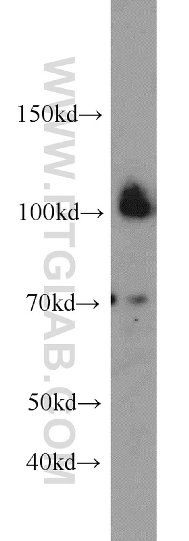 CUL4B Antibody in Western Blot (WB)