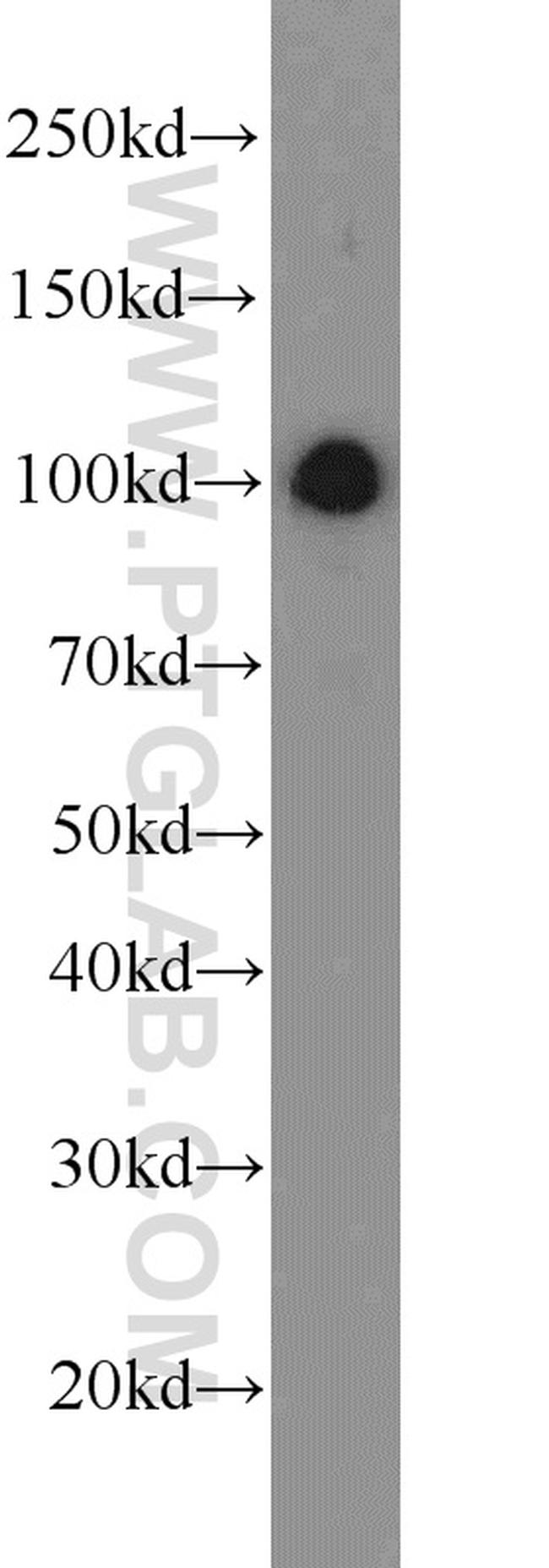 CUL4B Antibody in Western Blot (WB)