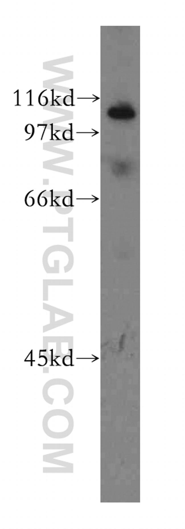 CUL4B Antibody in Western Blot (WB)