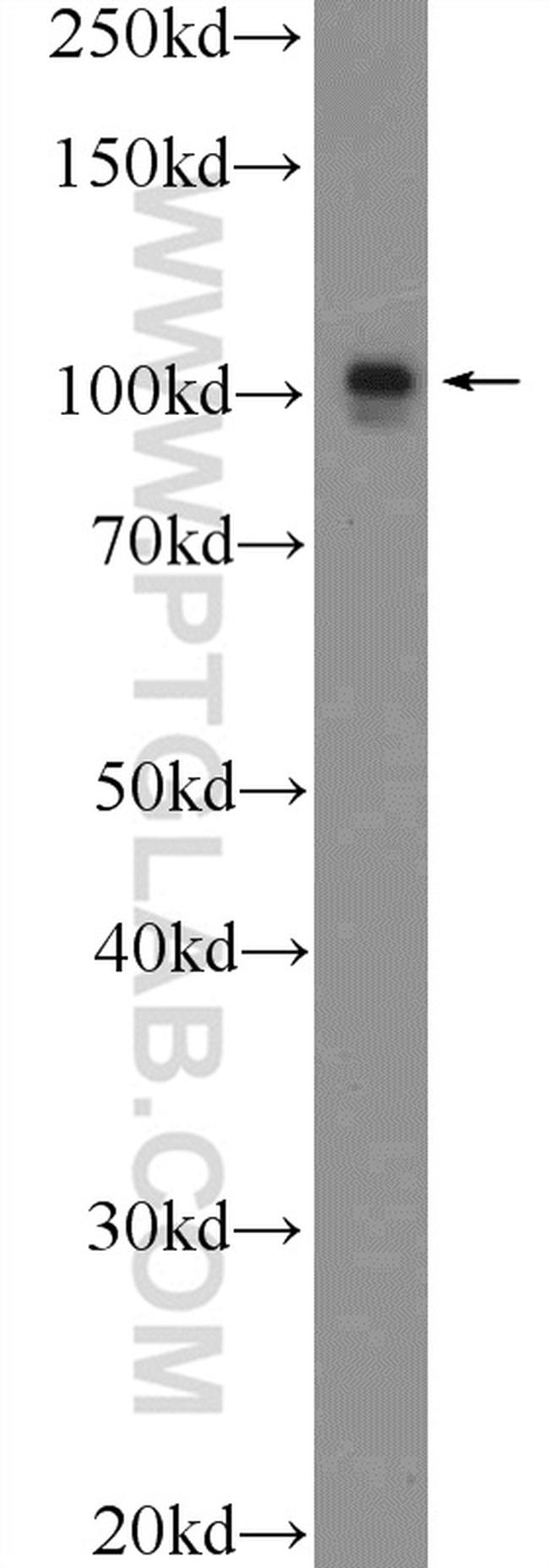 CUL4B Antibody in Western Blot (WB)