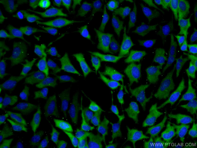 PDE4D Antibody in Immunocytochemistry (ICC/IF)