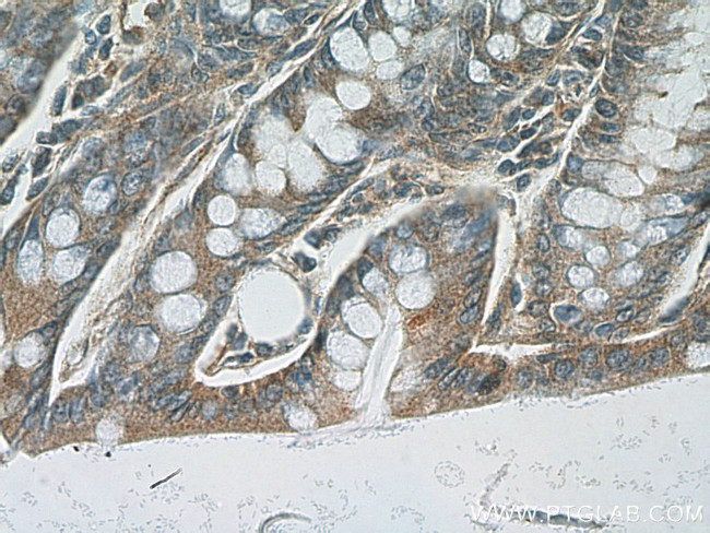 PDE4D Antibody in Immunohistochemistry (Paraffin) (IHC (P))