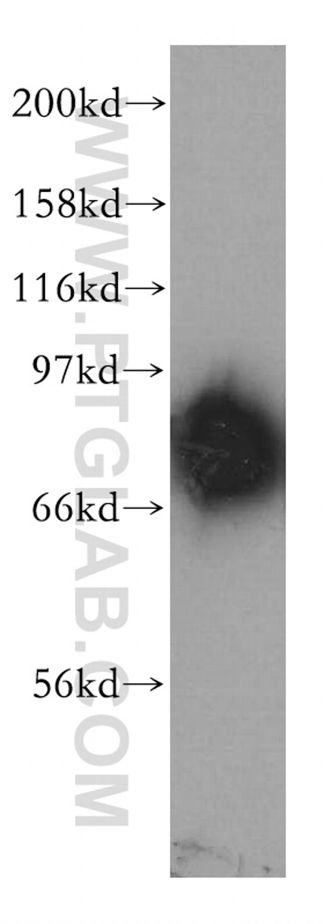 PDE4D Antibody in Western Blot (WB)