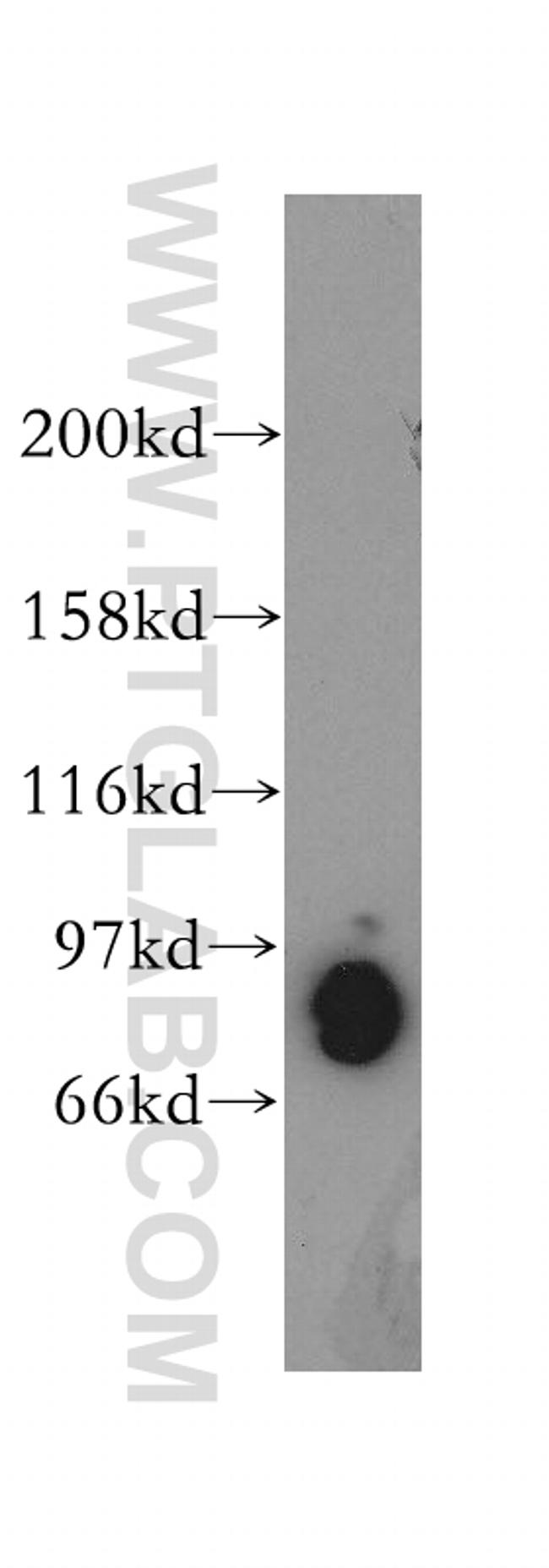 PDE4D Antibody in Western Blot (WB)