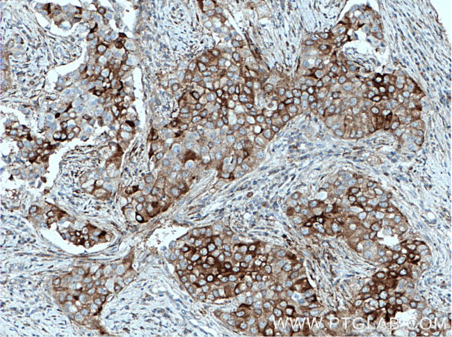 PKC beta Antibody in Immunohistochemistry (Paraffin) (IHC (P))