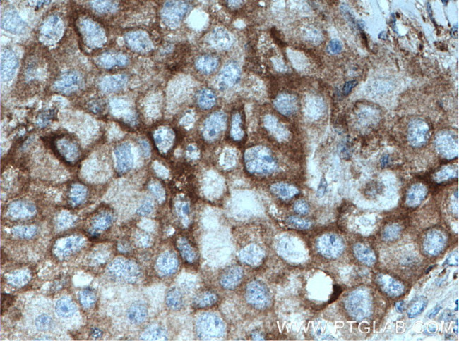 PKC Pan Antibody in Immunohistochemistry (Paraffin) (IHC (P))