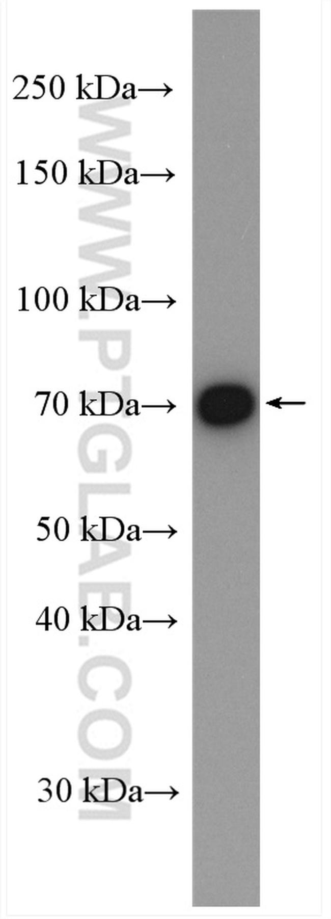 PKC beta Antibody in Western Blot (WB)