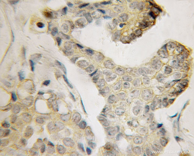 BVES Antibody in Immunohistochemistry (Paraffin) (IHC (P))