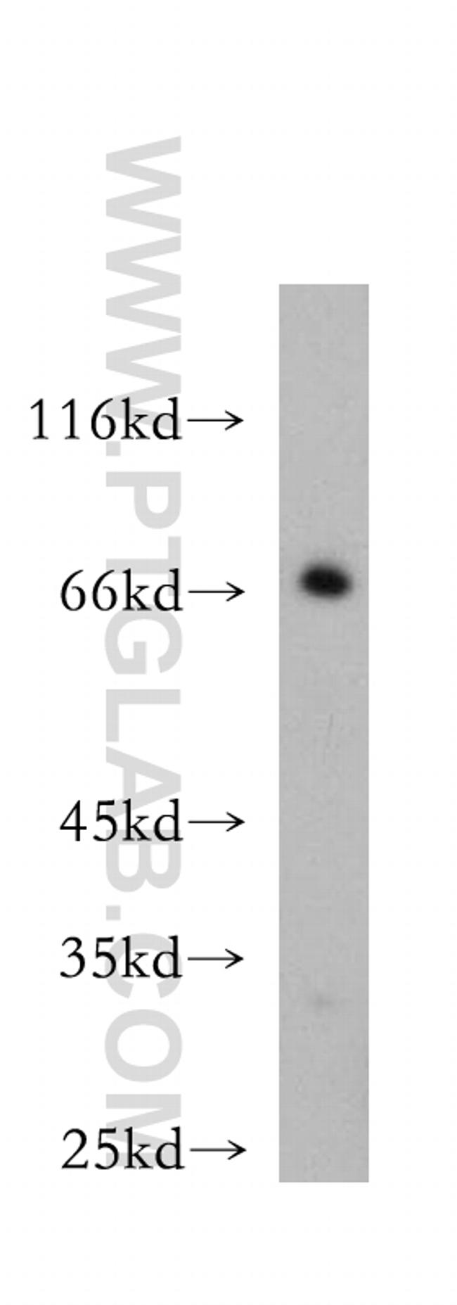 BVES Antibody in Western Blot (WB)