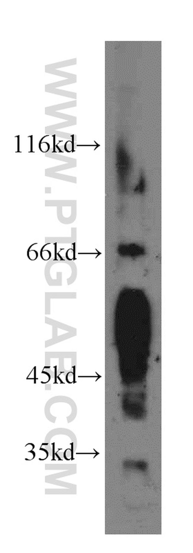 BVES Antibody in Western Blot (WB)