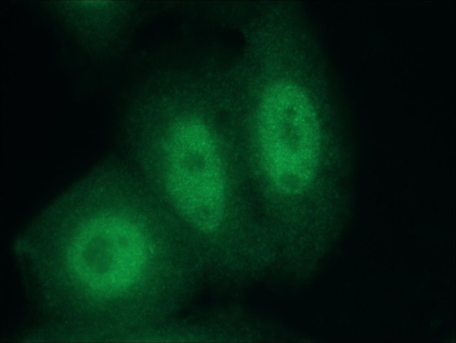 CUGBP2 Antibody in Immunocytochemistry (ICC/IF)