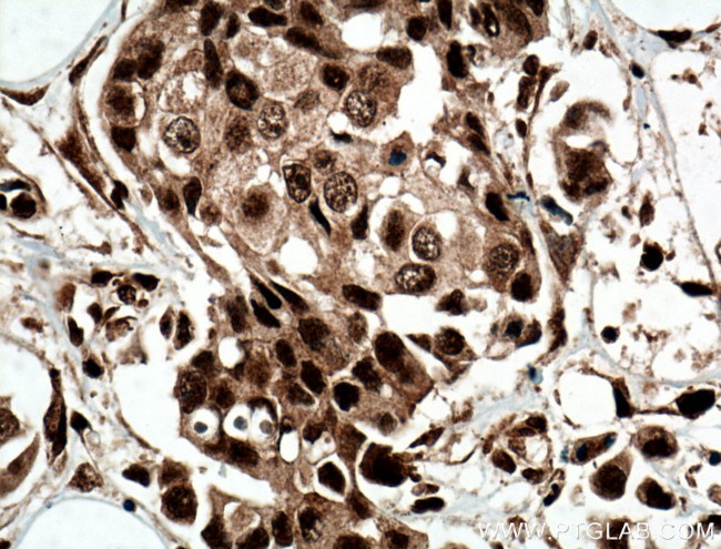 CUGBP2 Antibody in Immunohistochemistry (Paraffin) (IHC (P))