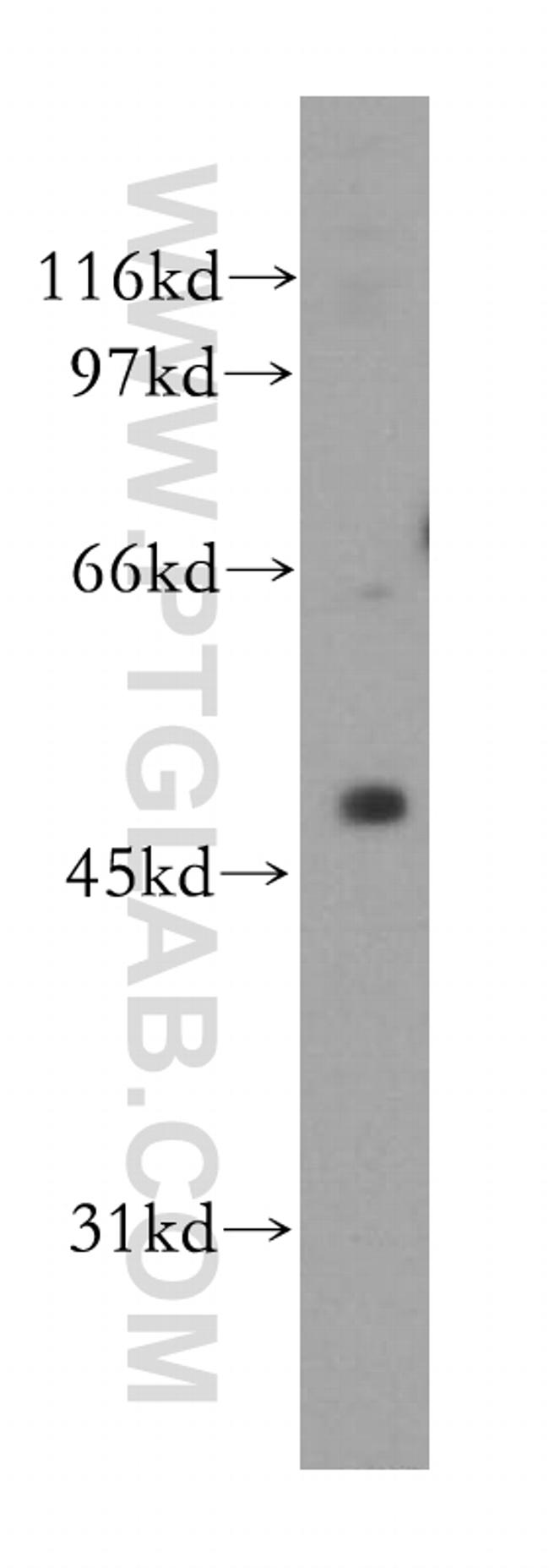 CUGBP2 Antibody in Western Blot (WB)