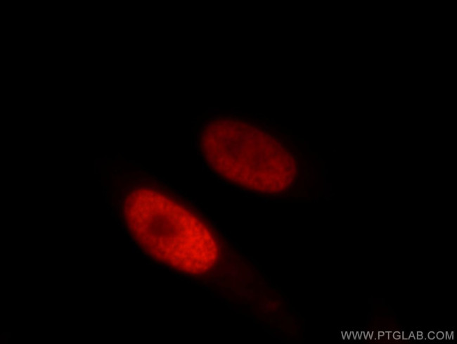 HDAC2 Antibody in Immunocytochemistry (ICC/IF)