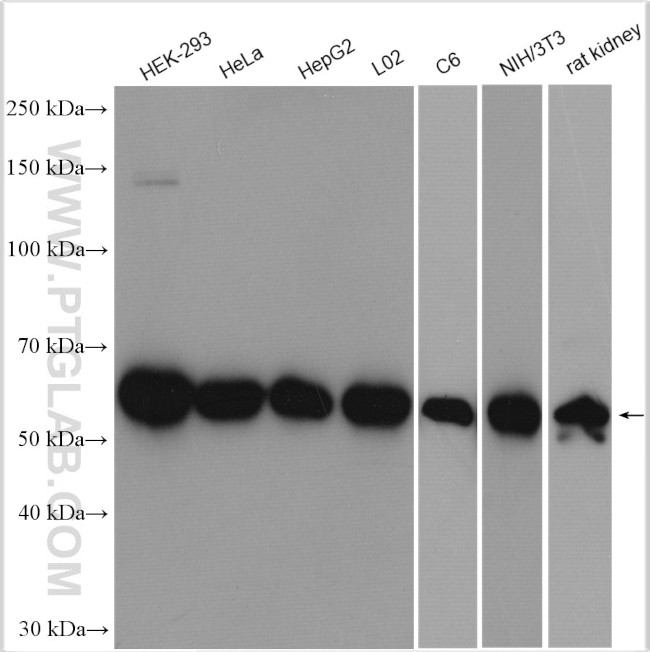 HDAC2 Antibody in Western Blot (WB)