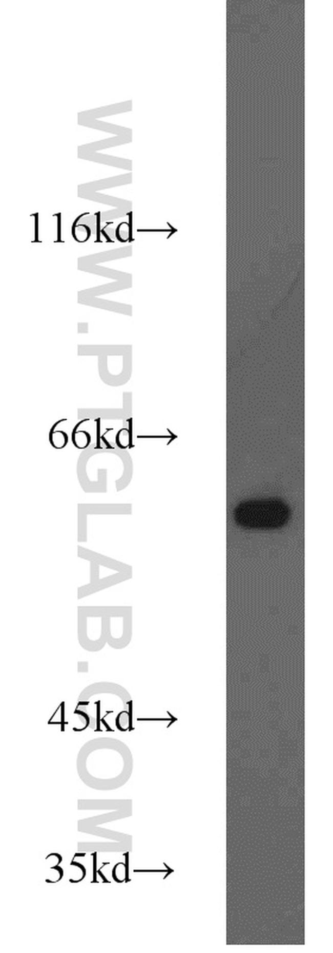 HDAC2 Antibody in Western Blot (WB)